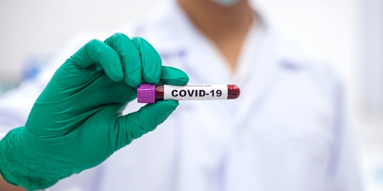 Koronavírus antitest vizsgálat 10.000 Ft